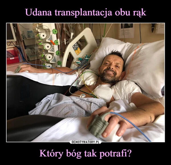 Udana transplantacja obu rąk Który bóg tak potrafi?