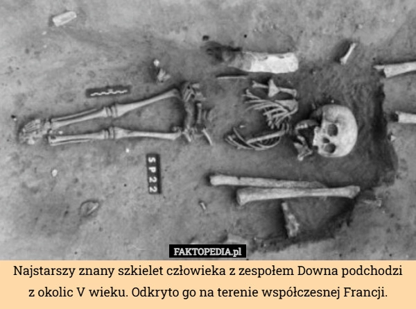 Najstarszy znany szkielet człowieka z zespołem Downa podchodzi z okolic