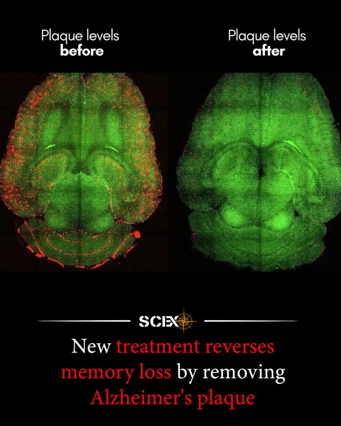 I can't wait to never hear about this again