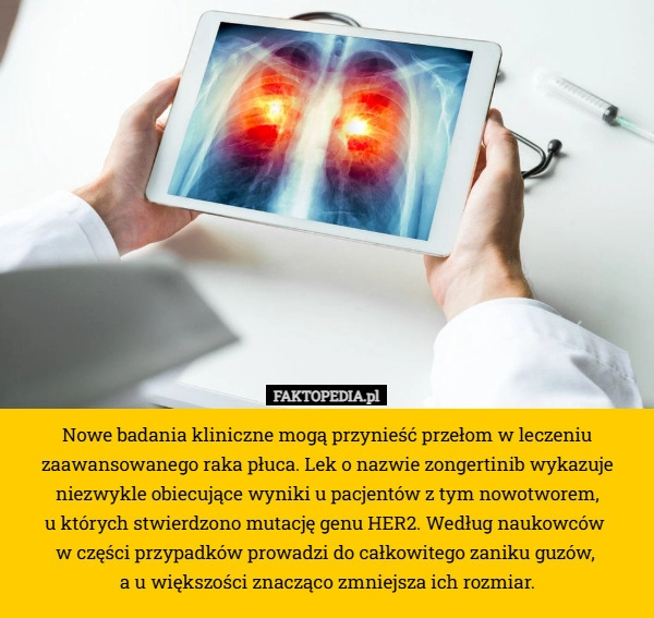 
    Nowe badania kliniczne mogą przynieść przełom w leczeniu zaawansowanego