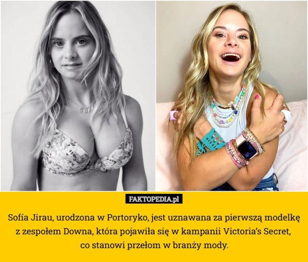 Sofía Jirau, urodzona w Portoryko, jest uznawana za pierwszą modelkę z zespołem