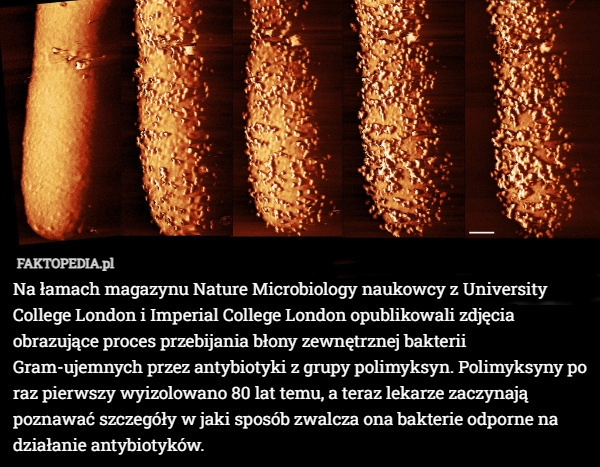 Na łamach magazynu Nature Microbiology naukowcy z University College London
