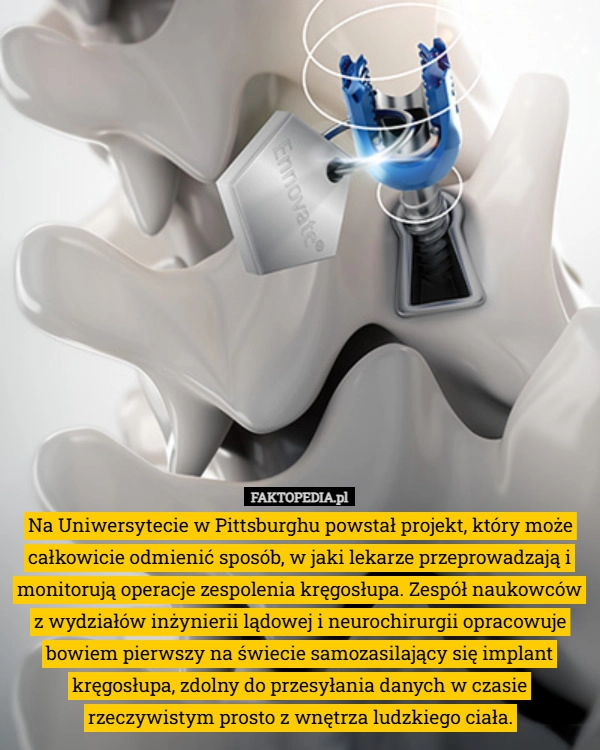 Na Uniwersytecie w Pittsburghu powstał projekt, który może całkowicie odmienić...