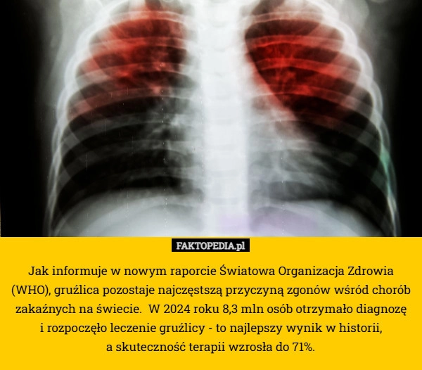 Jak informuje w nowym raporcie Światowa Organizacja Zdrowia (WHO), gruźlica